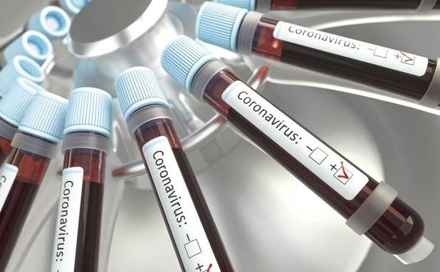 ‏ ‏
وزارة الصحة: 86 إصابة جديدة بفيروس كورونا