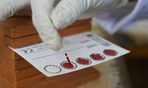 فرنسا تلزم القادمين من دول الاتحاد الأوروبي بإجراء PCR